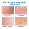 EELHOE Hyaluronic Acid Serum for Blemish-Prone Skin