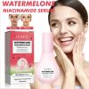 EELHOE Watermelon Niacinamide Serum with Sodium Hyaluronate