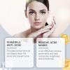 Acne Soothing Serum Facial Skin Hydration Moisturizing Acne Pit Pimple Gentle Care Solution