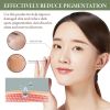 OceAura 5% Niacinamide Serum, Chun White Tender Skin Fade Spots Brighten Moisturizing Skin Fine Pores