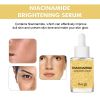 Hoygi Niacinamide Brightening Serum
